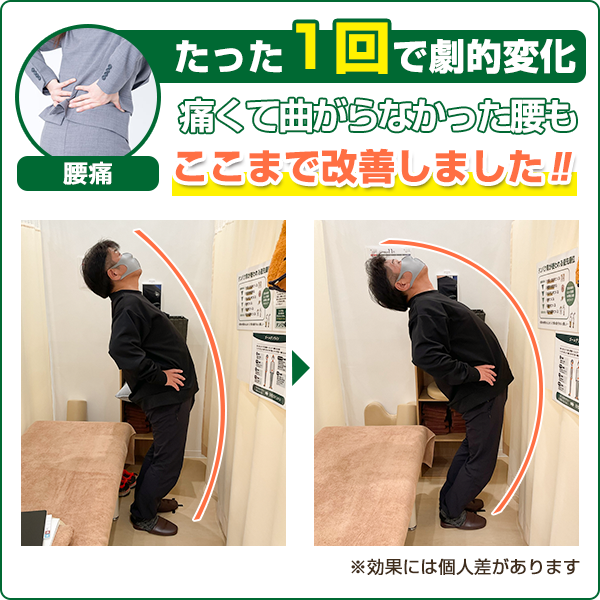 ビフォーアフター